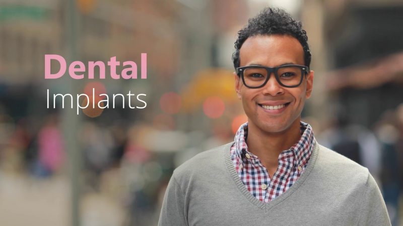 Dental Implants video thumbnail
